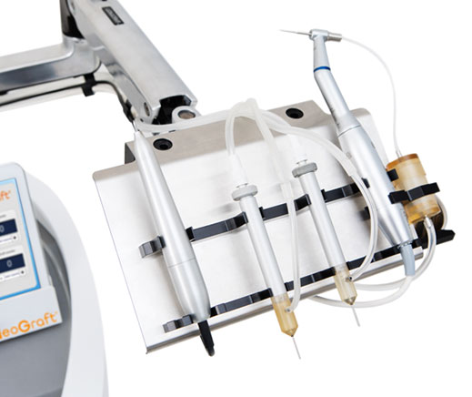 апарат NeoGraft