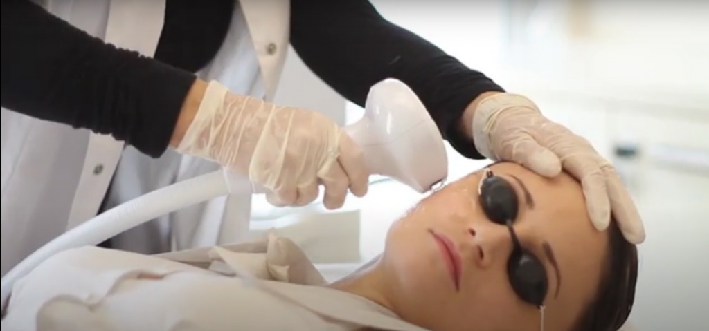 Процедура с Lumecca