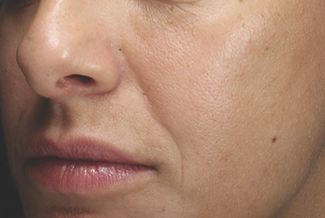 След процедура с FraxPro