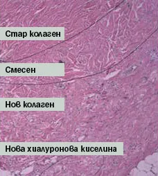 неоколагенеза Profound