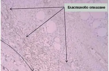 неоелогенеза Profound