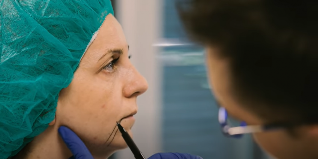 Процедура Bodytight видео