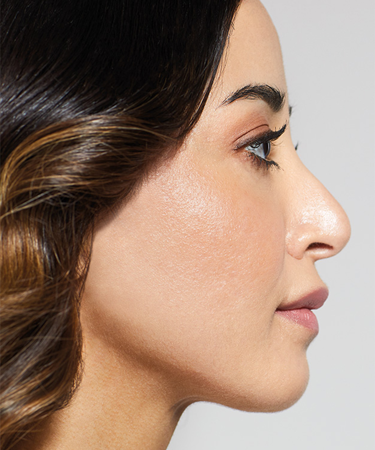 Филър MaiLi преди инжекциране на продукта