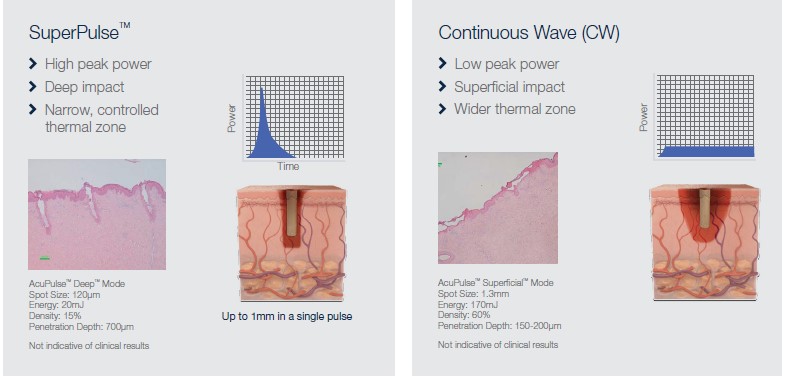 AcuPulse New Graphic